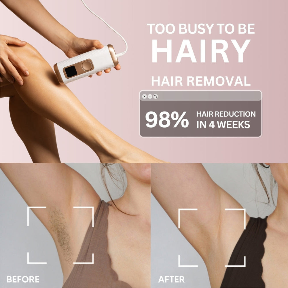 IPL Pro Permanent Laser Hair Removal