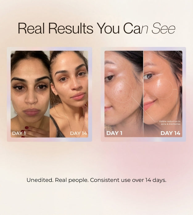 4-in-1 Skincare Wand