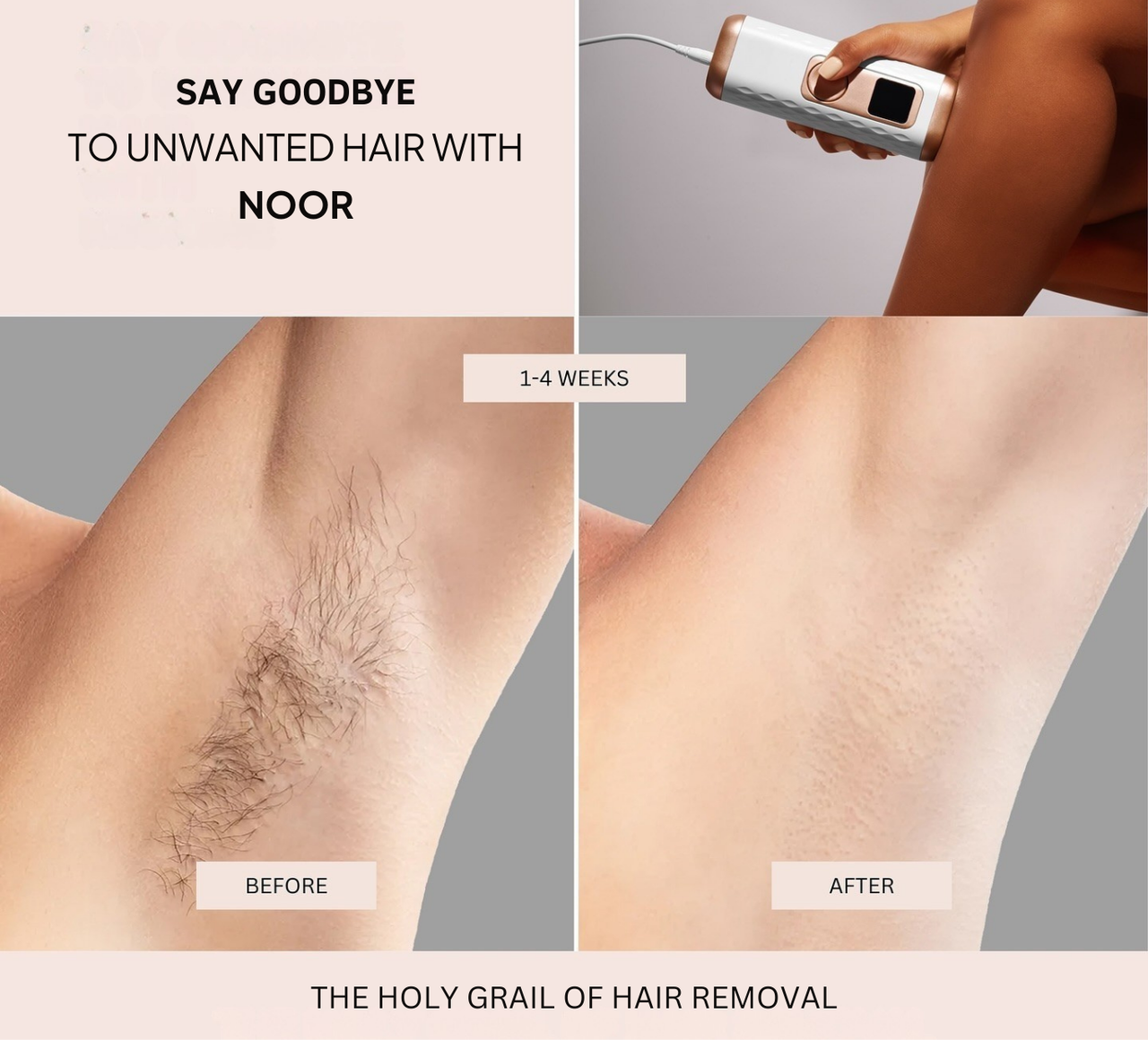 IPL Permanent Hair Removal Pro