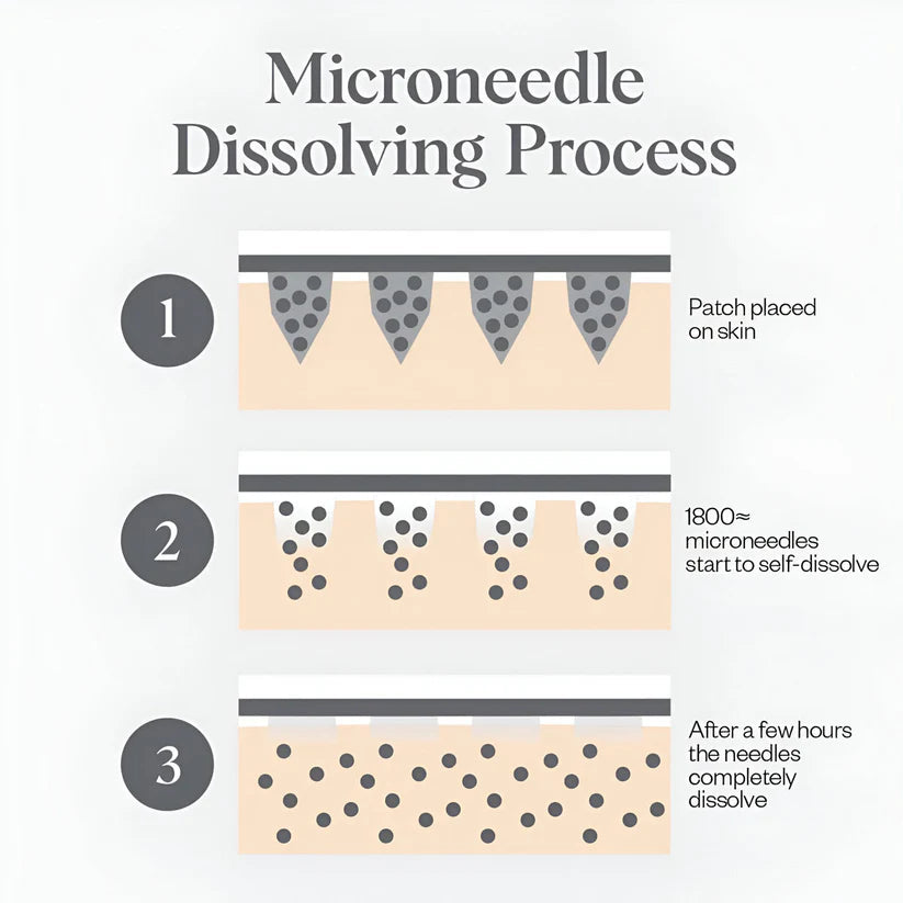 Noor Micro-Infusion Targeted Patches