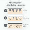 Noor Micro-Infusion Targeted Patches